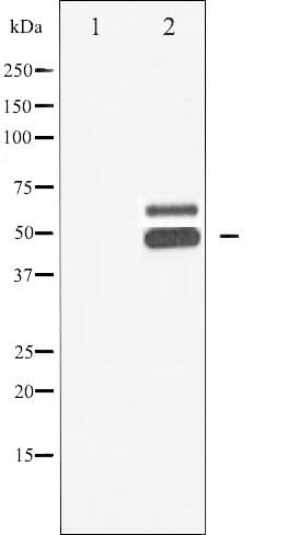 Polyclonal Rabbit anti-Human CaMKII Beta+Gamma+Delta Antibody (phospho-Thr287, IHC, WB)