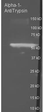 SERPINA1 / Alpha 1 Antitrypsin Antibody