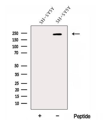 Polyclonal Rabbit anti-Human DOCK3 Antibody (WB)