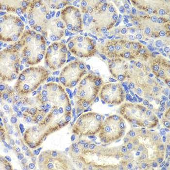 ST3GAL4 / ST3Gal IV Antibody