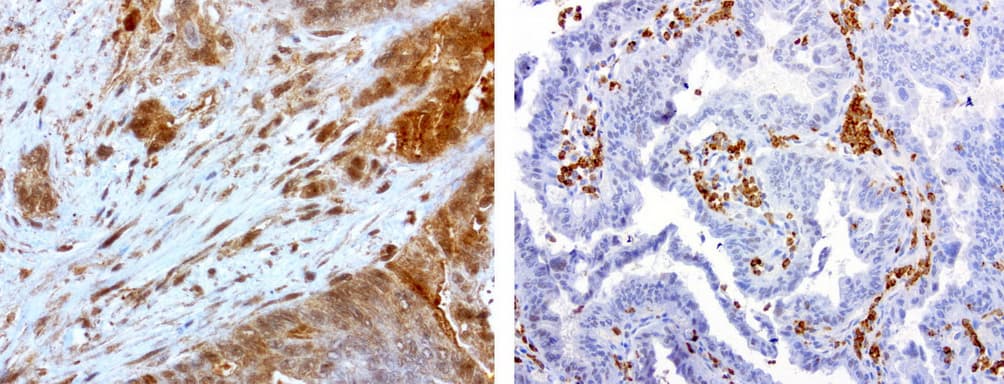MMP7 / Matrilysin Antibody (aa95-267, clone UMAB168)