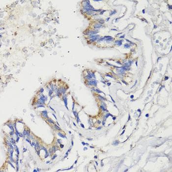 DEPTOR / DEPDC6 Antibody