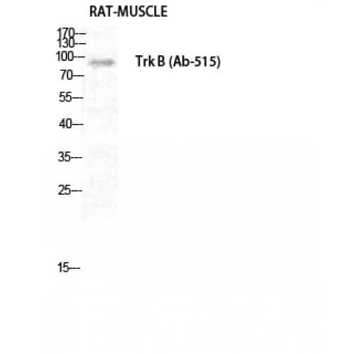 NTRK2 / TRKB Antibody (450-530 aa)