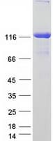 Human COL6A2 / Collagen VI Alpha 2 Protein (Recombinant Myc-DDK (Flag))
