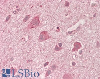IHC-plus™ DDIT3 / CHOP Antibody (10-90 aa)