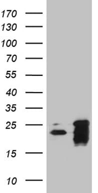 BAX Antibody (aa1-172, clone OTI2A1)