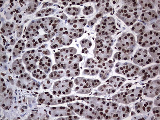 HNRPM / HNRNPM Antibody (aa1-261, clone OTI6H7)