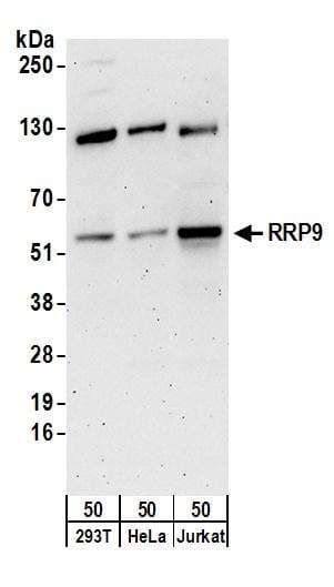 IHC-plus™ SP1 Antibody (aa735-785)