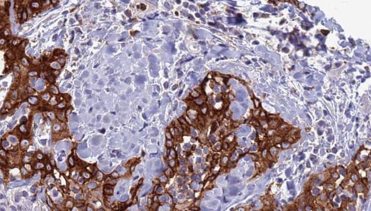 Polyclonal Rabbit anti-Human CLEC4D / MCL Antibody (IHC, WB)