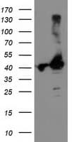 TBC1D21 Antibody (clone OTI2A6, Carrier-free)