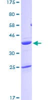 Human PFN2 / Profilin 2 Protein (Recombinant GST)