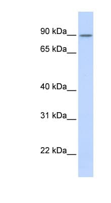 Polyclonal Rabbit anti-Human ZNF408 / PRDM17 Antibody (aa576-625, WB)