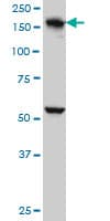 Monoclonal Mouse anti-Human EEA1 Antibody (clone 1D4, WB)
