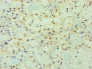 Polyclonal Rabbit anti-Human PRMT2 Antibody (aa1-300, IHC, WB)