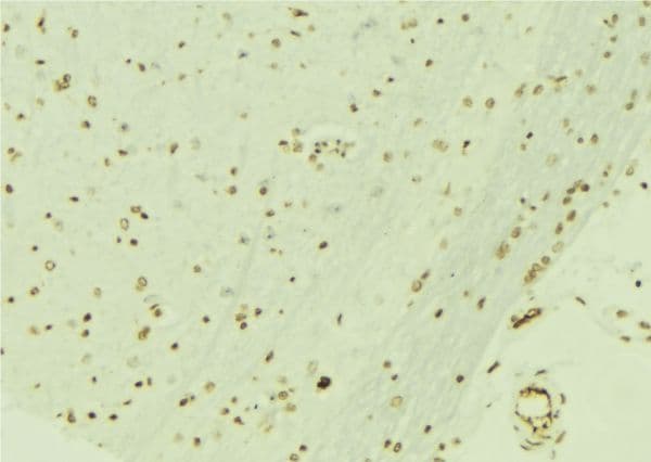 Polyclonal Rabbit anti-Human RBBP4 / RBAP48 Antibody (IHC, WB)