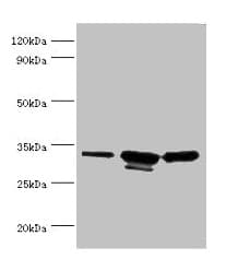 Polyclonal Rabbit anti-Human CAPZB / CAPZ Beta Antibody (aa1-272, IHC, WB)