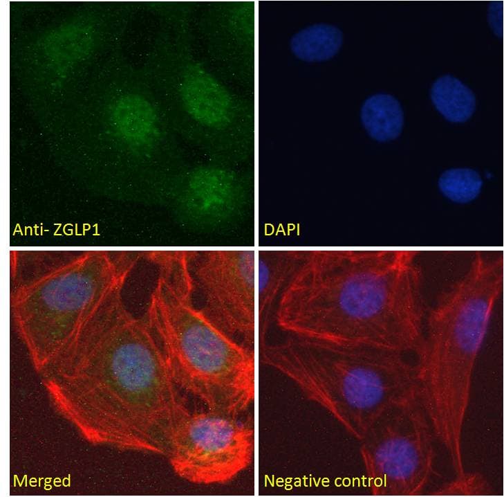 ZGLP1 Antibody (aa145-157)