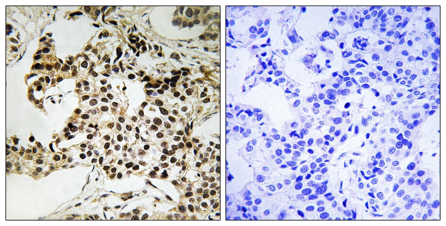 PRKRIR Antibody (phospho-Thr258)