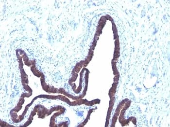 Cytokeratin 8+18 Antibody (clone KRT8/803 + KRT18/835)