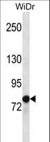 LZTS2 Antibody (aa572-601)