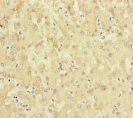 SLC6A12 / BGT-1 Antibody