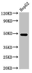 Polyclonal Rabbit anti-Human FDPS Antibody (IHC, WB)