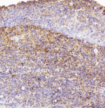 EML4 Antibody