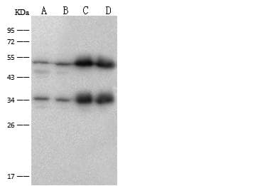 Polyclonal Rabbit anti-Human ATP5B / ATP Synthase Beta Antibody (Preservative Free, IHC, WB)
