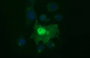 SIVA1 / SIVA Antibody (clone OTI1B10, Carrier-free)