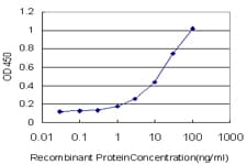 ADCY2 / Adenylate Cyclase 2 Antibody (clone 1D4)