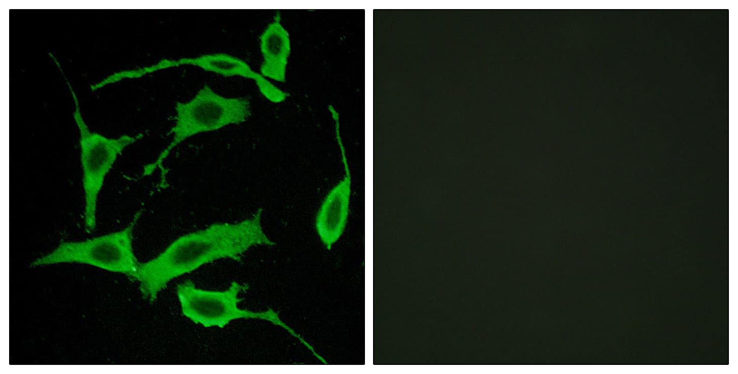 SREB / GPR85 Antibody (aa181-230)