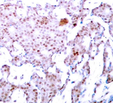 RELA / NFKB p65 Antibody (phospho-Ser536)
