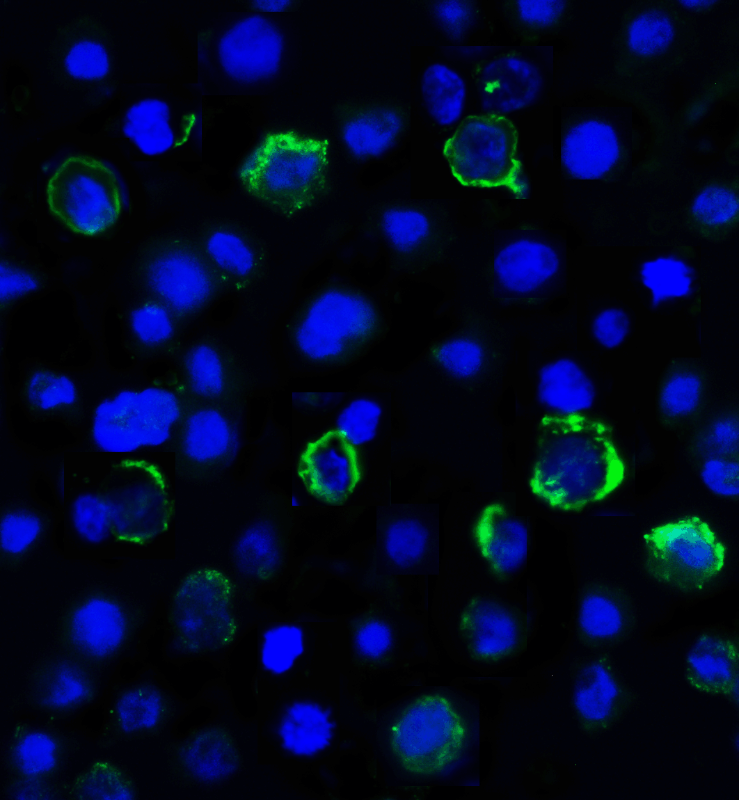LAG3 Antibody (clone 6D1)
