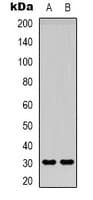 Adiponectin Antibody (Internal)