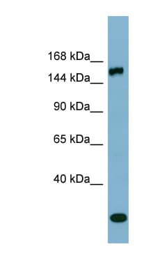 EPRS / PARS Antibody (aa971-1020)