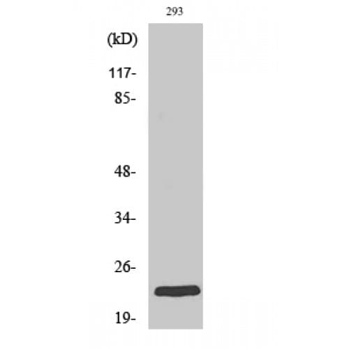 RAB35 Antibody (70-150 aa, Internal)