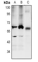 LPCAT2 Antibody