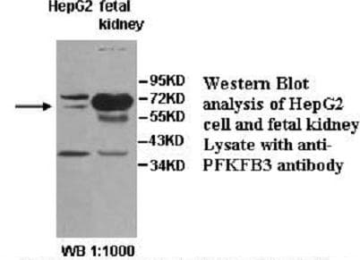 PFK2 / PFKFB3 Antibody (aa55-307)
