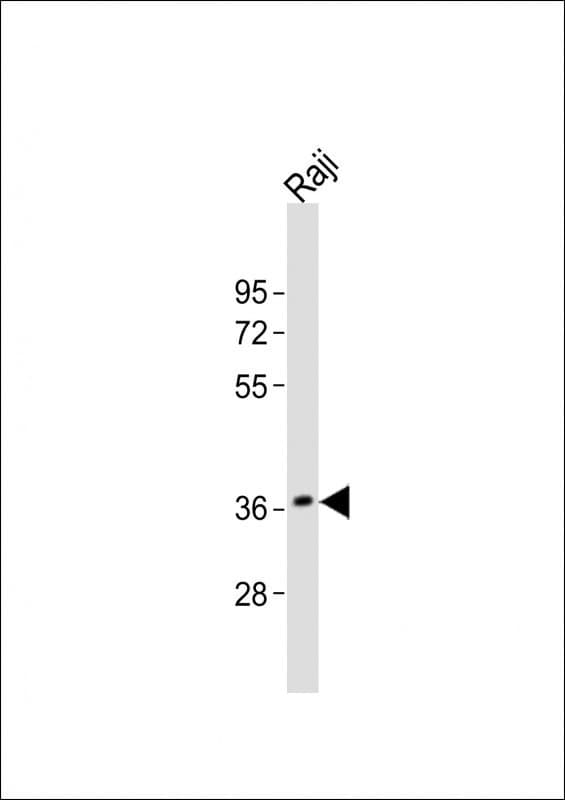 RASSF2 Antibody (aa64-98)