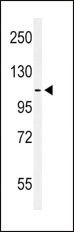 EPHA2 / EPH Receptor A2 Antibody (aa30-60)