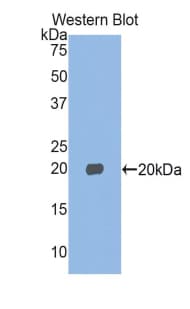 MYL2 Antibody (aa2-159)