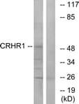 CRFR1 / CRHR1 Antibody (aa75-124)