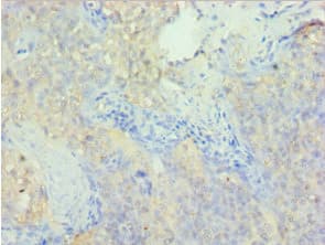 Polyclonal Rabbit anti-Human PDLIM1 Antibody (aa1-329, IHC, WB)