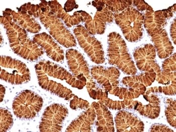 MUC5AC Antibody (clone MUC5AC/917 + 45M1, Ready-to-Use)