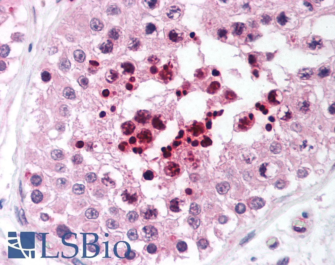 IHC-plus™ RIF1 Antibody (aa2375-aa2419)