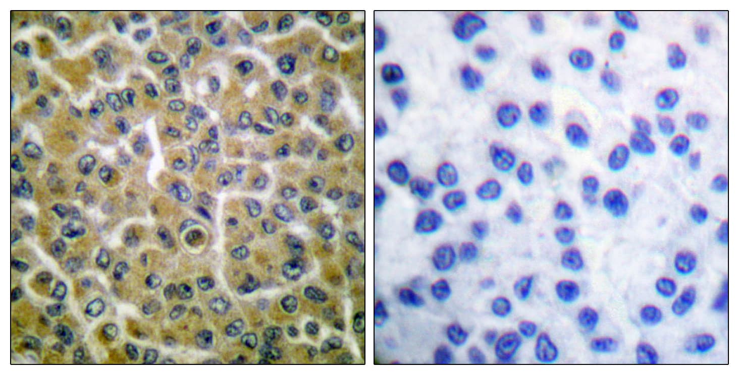 PLCG2 / PLC Gamma 2 Antibody (phospho-Tyr753)