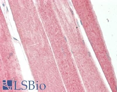 IHC-plus™ Polyclonal Rabbit anti-Human HK2 / Hexokinase 2 Antibody (IHC, IF, WB)