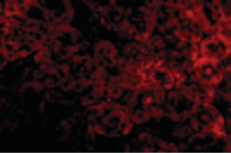 IL1RL1 Antibody