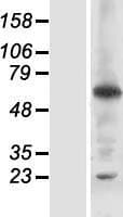 RNF25 Protein (Over-Expression Lysate Myc-DDK (Flag))