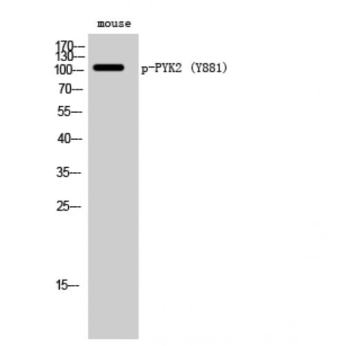 PTK2B / PYK2 Antibody (820-900 aa)